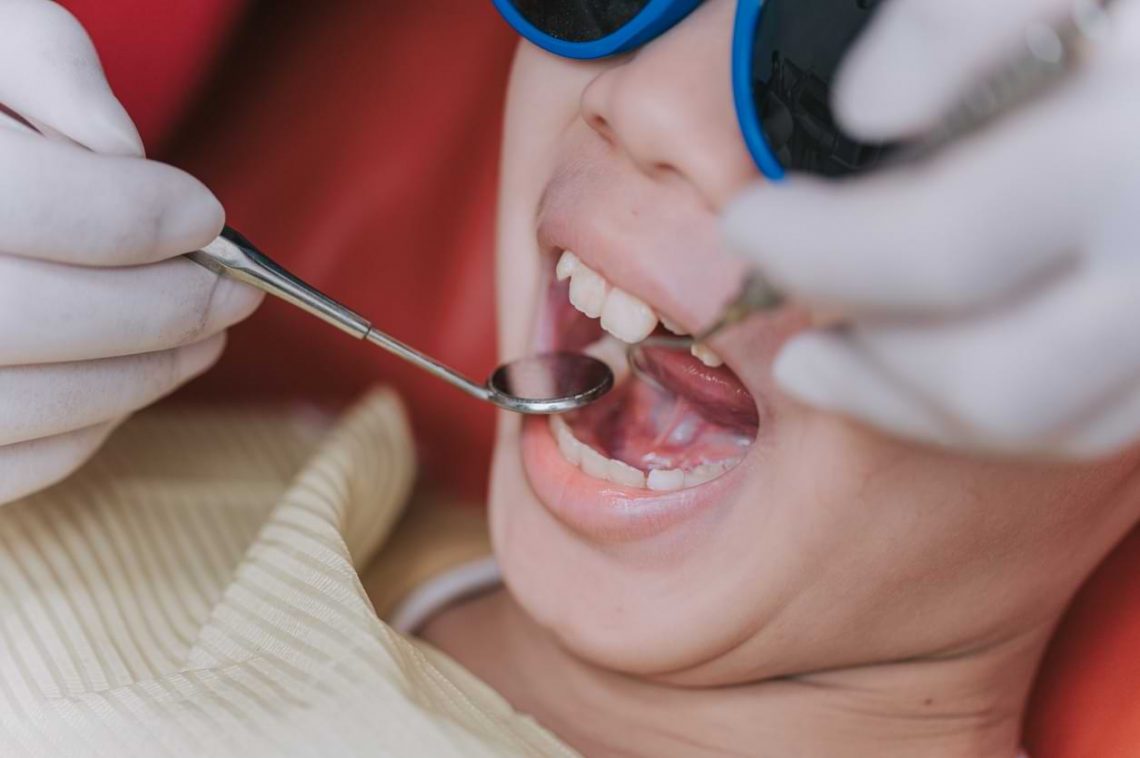 why-do-root-canals-cost-so-much-abbotsford-dental-clinic